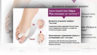 уникальный корректор valgus plus отзывы

  - Valgus Pro - Обзор Фиксатора