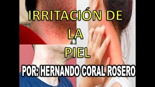 IRRITACIÓN DE LA PIEL. Piel roja y dolorosa por frotación continua.