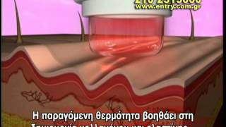 Entry ΣΥΣΚΕΥΗ ΚΑΘΑΡΙΣΜΟΥ ΓΙΑ ΤΟ ΔΕΡΜΑ Oxycare by Dermawand