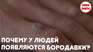 Почему у людей появляются бородавки?