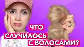 Я ЛЫСАЯ? ЧТО СЛУЧИЛОСЬ С ВОЛОСАМИ? ПОЧЕМУ ВСЕГДА в КЕПКЕ?