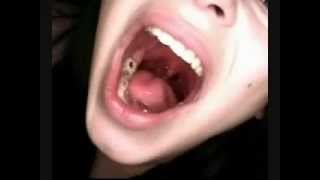 multi gummy worm swallow / vore