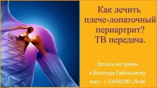 Плечелопаточный периартрит лечение остеопатией
