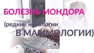 БОЛЕЗНЬ МОНДОРА. Редкая болезнь молочных желёз!