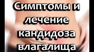 Молочница на половых губах