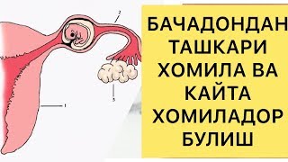 Бачадондан ташкари хомиладорлик! Битта труба билан хам хомиладор булиш