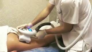 Комплексная процедура по моделированию и коррекции фигуры аппаратом SLIMMING IV