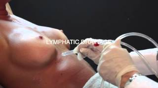 Процедура омоложения груди на системе Jet Peel