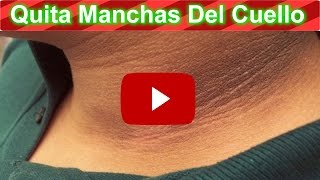 Mira Esta Pasta Para Quitar Las Manchas Del Cuello Rapidamente