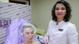 Устранение носослезной борозды