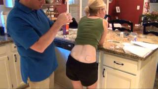 IVF first Progesterone Injection