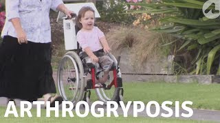 An Unusual Condition: Arthrogryposis