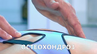 На приеме у доктора Ороса. Остеохондроз | Телеканал «Доктор»