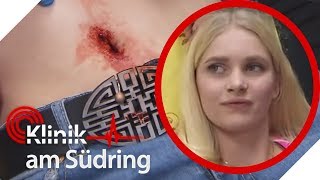 Sophie (16) blutet aus dem Bauchnabel: Sie will sexy für Jungs sein! | Klinik am Südring | SAT.1 TV
