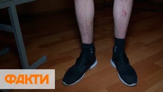 Пытки и насилие: как издеваются над заключенными в харьковской колонии