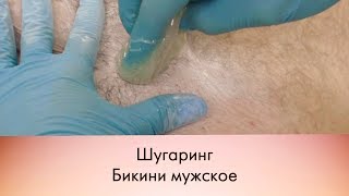 Шугаринг бикини мужское\Sugaring bikini men's