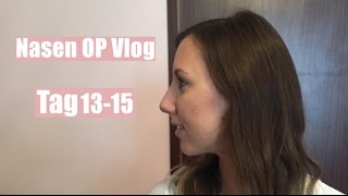 Nasen OP Vlog Tag 13-15 | Vorläufiges Endergebnis