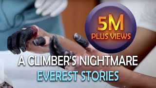 Frostbite - A Climber's Nightmare | Everest Stories