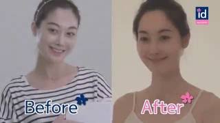 phẫu thuật gọt hàm Vline Hàn Quốc- Bác sĩ Thay đổi cuộc sống