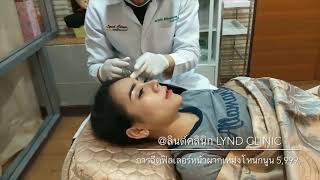 ??‍⚕️ หลังฉีดฟิลเลอร์หน้าผากเหม่งโหนกนูนที่ลินด์จะสวยขนาดไหนต้องกดดูค่ะ ??‍⚕️