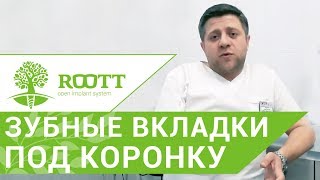Вкладки под коронки. ? Зачем устанавливают вкладки под коронки? ROOTT. 12+