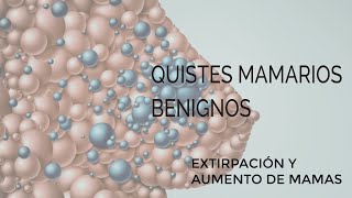 Quistes benignos mamas, extirpación y aumento Dr Torres Fortich