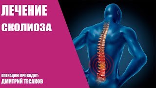 Лечение сколиоза/Операция