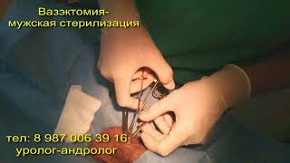 Вазэктомия, Мужская стерилизация, контрацепция.