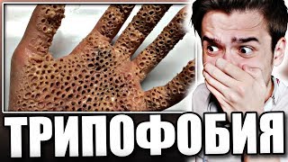 Реакция на ТРИПОФОБИЮ |ТЕСТ|