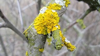 Maladie génitale : qu'est-ce qu'un lichen vulvaire ?
