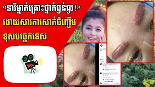 នារី​ម្នាក់​គ្រោះ​ថ្នាក់​ធ្ងន់​ធ្ងរ ដោយ​សារ​ការ​សាក់​ចិញ្ចើម​ខុស​បច្ចេក​ទេស, Khmer News, Stand Up