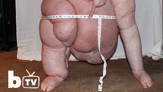 My Giant 150lbs Leg