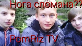 Шок! У Фила сломана нога?? Ответы на вопросы