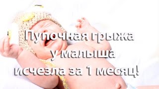 Пупочная грыжа у малыша исчезла за 1 месяц! Массаж при пупочной грыже. Полезные советы.