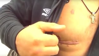 Видео с бодикамеры полицейского. Убийство полицейских в Днепре.