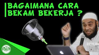 Bagaimana cara Bekam Bekerja mengobati Tubuh ? - dr Zaidul Akbar