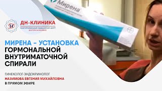 МИРЕНА - УСТАНОВКА внутриматочной гормональной спирали.