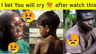 ?Corona Virus ? ? heart  touching images .. corona Virus images
