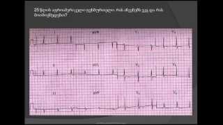 ecg interpretation. ჰიპერტროფიული კარდიომიოპათია (hipertrofiuli kardiomiopatia)