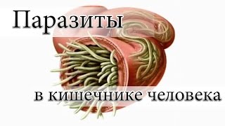 Паразиты в кишечнике человека