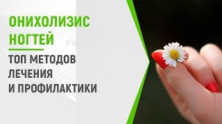 Онихолизис ногтей: ТОП методов лечения и профилактики