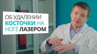 Об удалении косточки на ноге лазером Алексей Олейник FootClinic