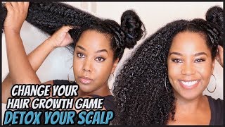 Why Detoxing Your Scalp & Natural Hair Is A MUST | Hair Growth | Melissa Denise