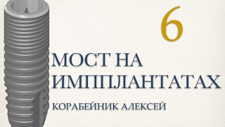 мост на имплантах