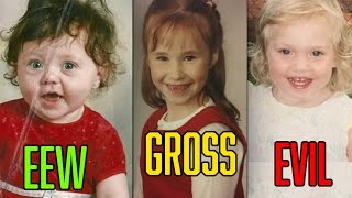 Puberty FIXED These Kids (Before & After Pictures)
