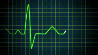 Cardiogram - Moho Pro 12 - ECG