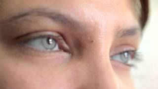 Cirugía para cambiar su color de ojos para siempre