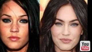 Celebrities After plastic surgery. Then and now pictures. It makes a big difference
