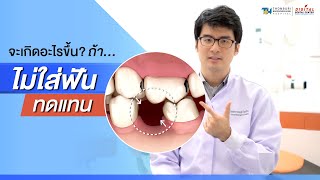 จะเกิดอะไรขึ้น หากไม่ใส่ฟันทดแทนในช่องฟันที่เสียไป | Digital Dental Center