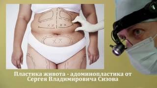 Абдоминопластика. Видео операции.